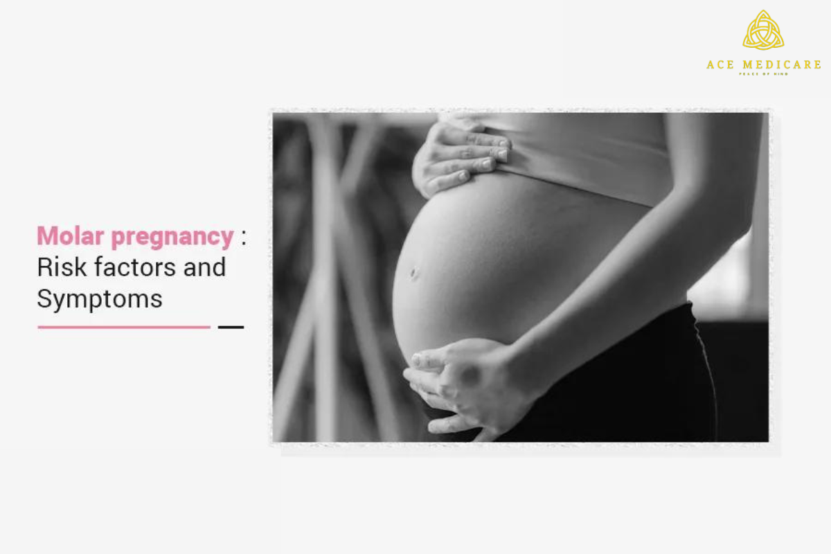 Molar Pregnancy: Understanding the Risks, Complications, and Recovery